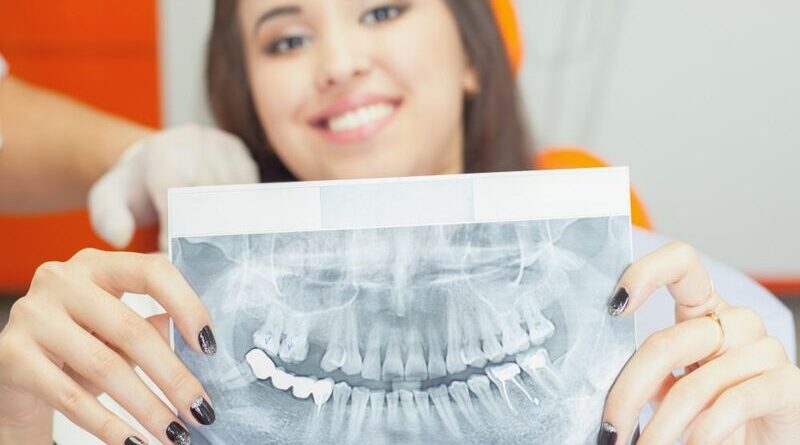 Современная имплантация зубов что нужно знать