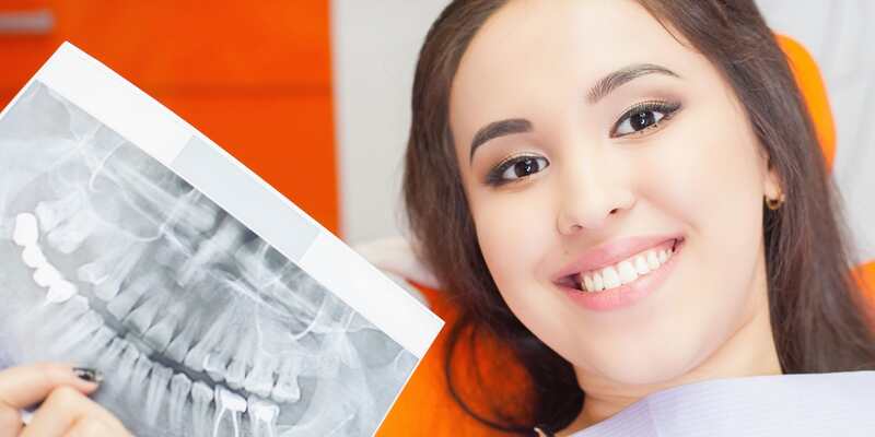 Зубные имплантанты миф и реальность