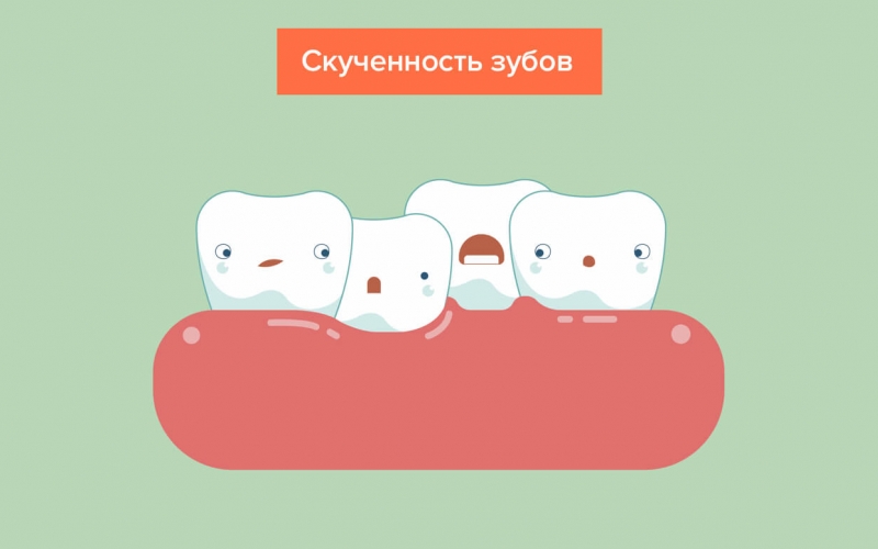 Прорезывание зубов у детей — порядок, сроки, симптомы,  схема роста и таблица с рождения