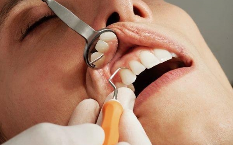 Зубной белок предотвращает потерю костной массы у мышей