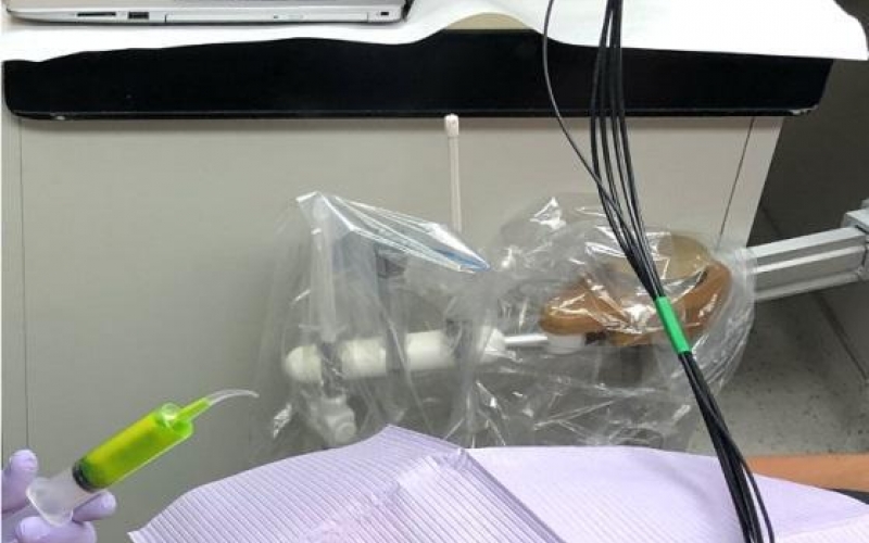 Исследователи представляют новое устройство для измерения кислотности зубной биопленки