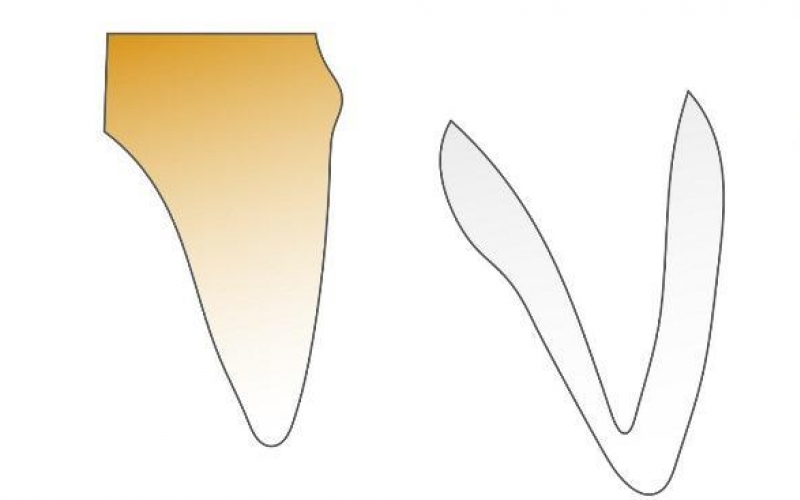 Цифровое определение оттенков зубов: практическое применение современного колориметра