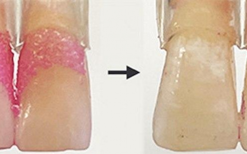 Нанороботы могут заменить обычную зубную щетку