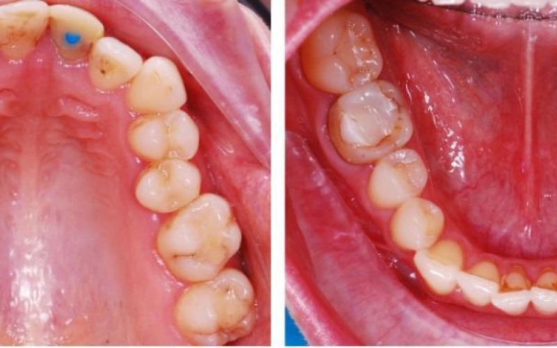 Комплексный подход в стоматологии
