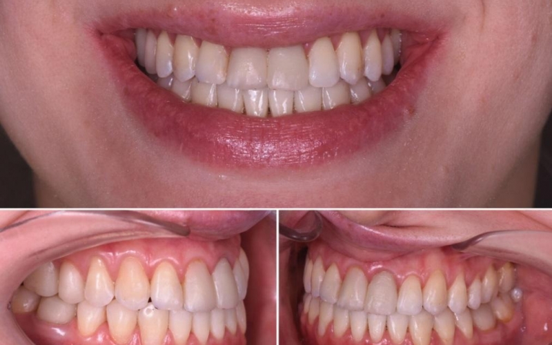 Комплексный подход в стоматологии