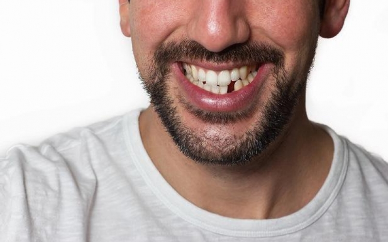 Вырастить новые зубы - мечта каждого стоматолога