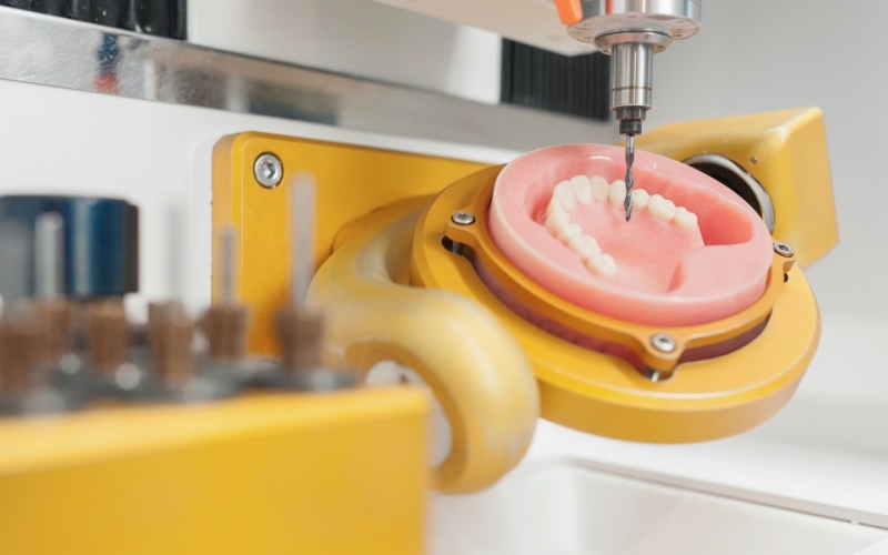 Виды зубных коронок: диоксид циркония и керамика против пластмассы и металлокерамики
