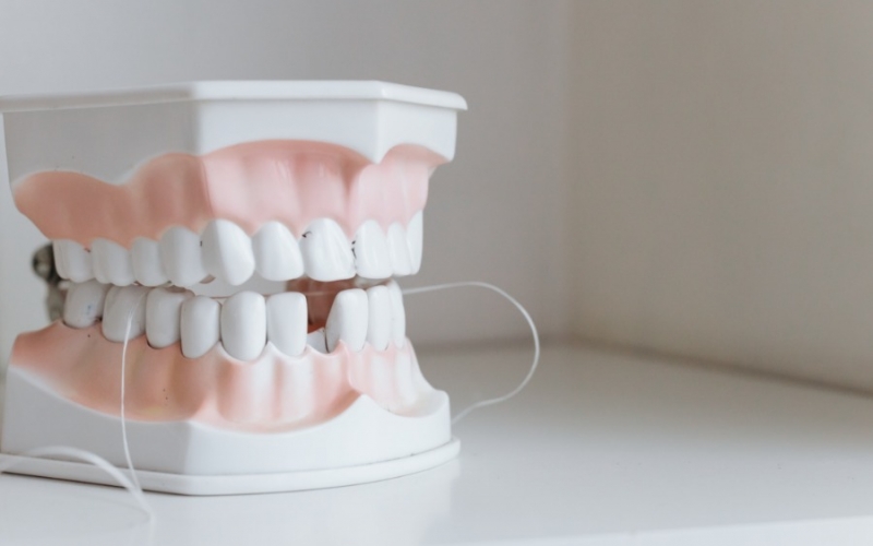 Зуб за зуб: 4 опасных симптома пародонтита, которые нельзя игнорировать